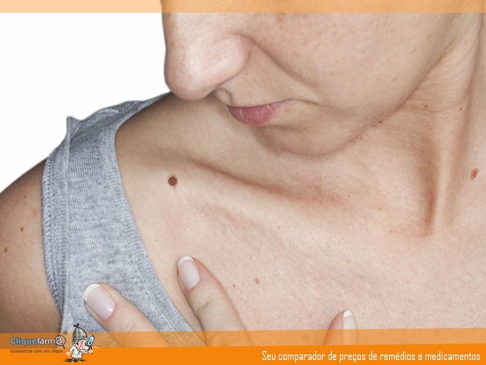 O que é Melanoma Metastático? O que é Melanoma Metastático?