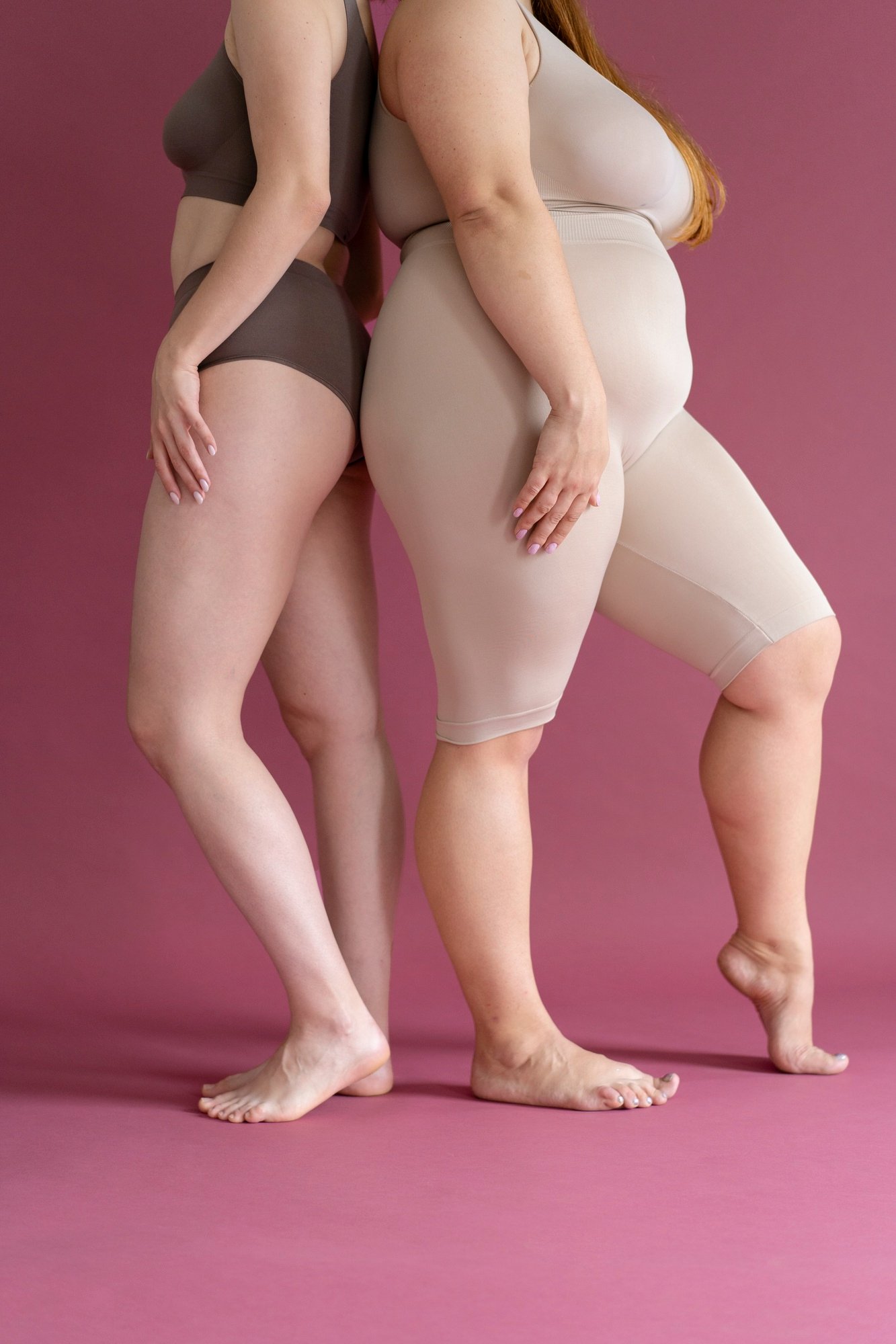 Lipedema. Imagem de Freepik.