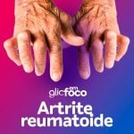 Artrite reumatoide: Glic em Foco.
