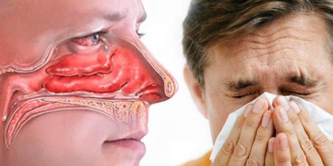Imagem Complementar do Dicloridrato de levocetirizina - 5 mg 10 comprimidos revestidos ranbaxy genérico