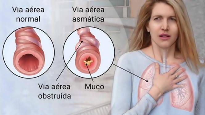Imagem Complementar do Flixotide - 250mcg spray 60doses