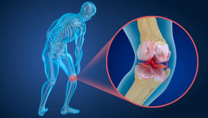 Libiam para osteoporose