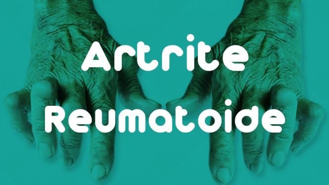 Motore para artrite reumatoide