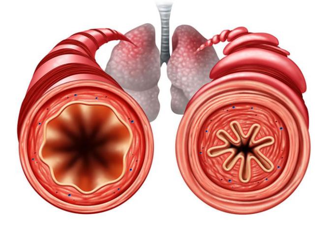 Imagem Complementar do Montelucaste de sódio 10mg 30 comprimidos - Eurofarma genérico