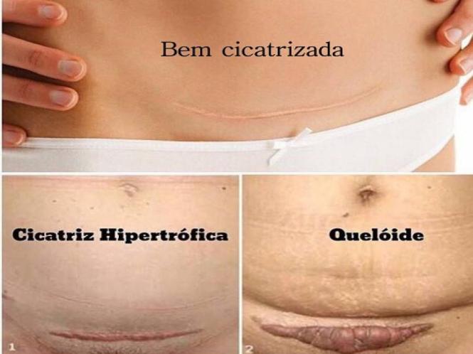 Imagem Complementar do Skimatix - Ultra Gel 15 G