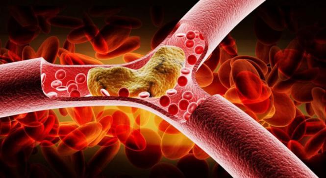 Imagem Complementar do Vytorin - 10mg + 20 mg 30 comprimidos branco