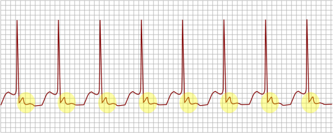 Imagem Complementar do Digoxina 0,25mg com 30 comprimidos - Pharlab genérico