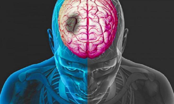 Imagem Complementar do Pradaxa - 150mg c 30 cápsulas