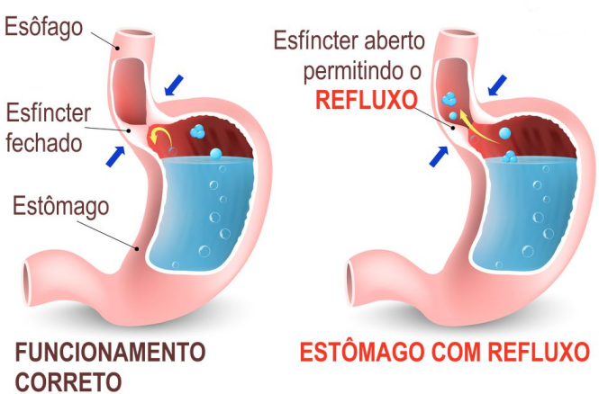 Imagem Complementar do Bromoprida 4Mg Ml Gotas Com 20Ml - Brainfarma Genérico