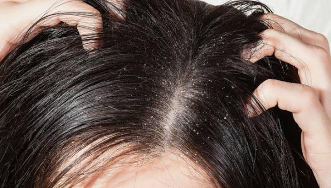 Imagem Complementar do Creme de Tratamento Anticaspa Doctar Noturno 100ml