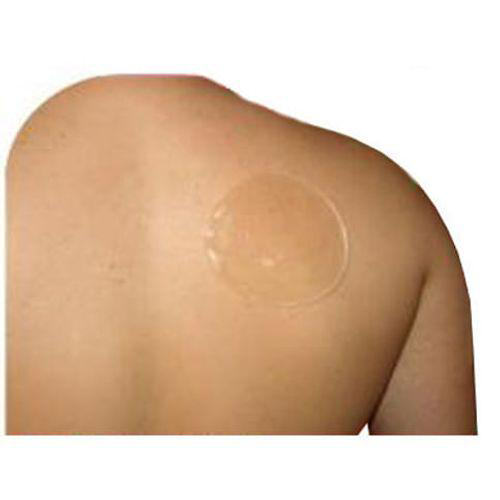Imagem do produto Disco Skingel 10 Cm Sg201 Ortho Pauher