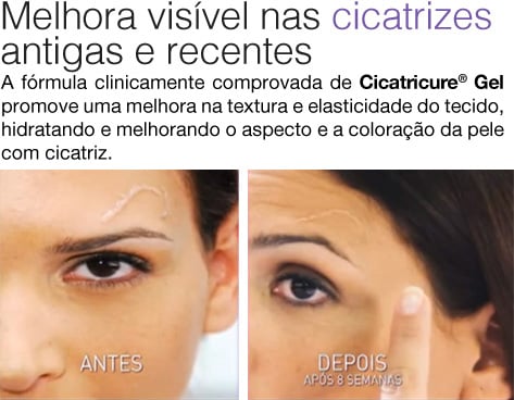 cicatricure-gel-cicatrizes-6