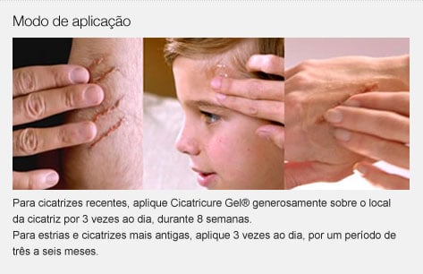 cicatricure-gel-cicatrizes-7