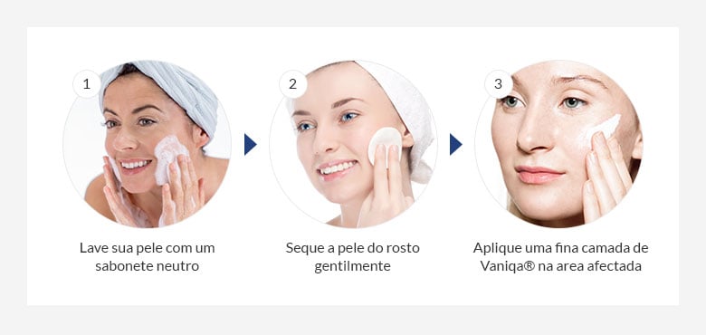 Imagem Complementar da Bula do VANIQA 11.5% 60G, 1