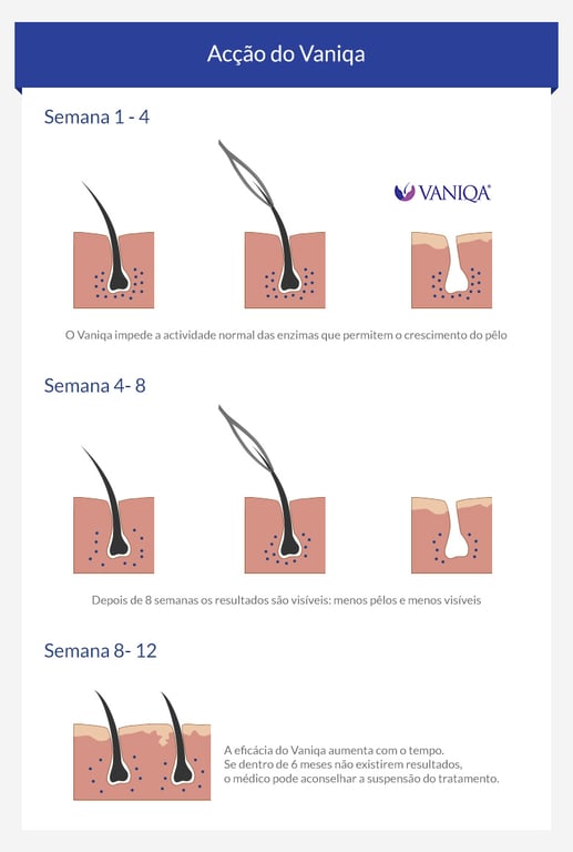 Imagem Complementar da Bula do VANIQA 11.5% 60G, 1