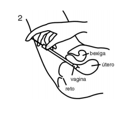 Imagem Complementar da Bula do Gino Canesten - 100Mg/5G 1 Creme Vaginal 20G + 3 Aplicadores