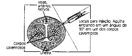 Imagem Complementar da Bula do Caverject - 10mcg C 1 Ampola E Seringa De 1ml, 2 Agulhas Estéreis E 2 Compressas Antissépticas Refrigerado
