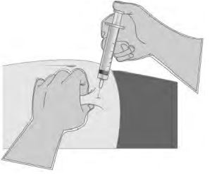 Imagem Complementar da Bula do Eligard - 22,5 Mg Pó Liofilizado Suspensão Injetável Subcutânea De Liberação Prolongada Seringa B + Agulha Dispositivo Segurança