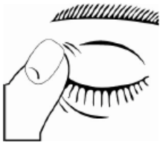Imagem Complementar da Bula do Dorzolamida - 2% e timolol 0,5% solução oftálmica com 5 ml teuto genérico
