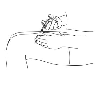 Imagem Complementar da Bula do Stelara - 90 mg solução injetável 1 seringa preenchida dispositivo segurança 1 ml