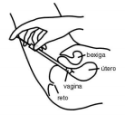 Imagem Complementar da Bula do Clotrimazol 20mg/g - Creme Vaginal 20g Medley Genérico