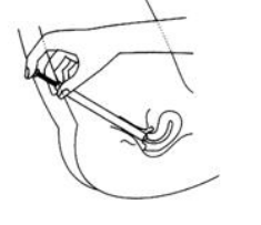Imagem Complementar da Bula do Metronidazol - Geleia vaginal com 55 g e 10 aplicadores neoquímica brainfarma genérico