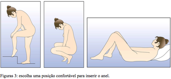 Imagem Complementar da Bula do nuvaring - 1 anel