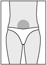 Imagem Complementar da Bula do Puregon pen 300ui cartucho c 1 carpule de 0,480ml e 6 agulha