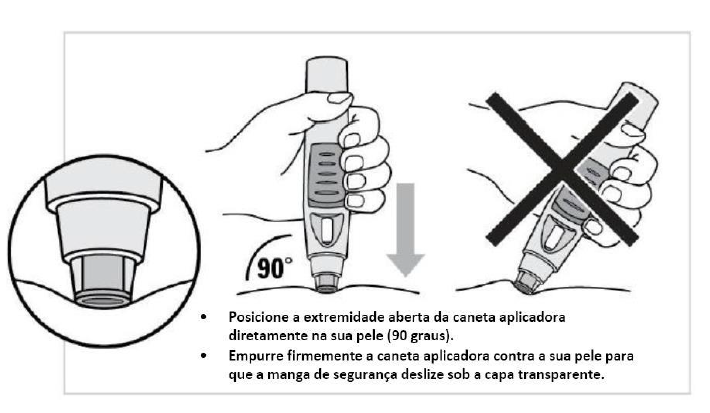 Imagem Complementar da Bula do Simponi 50Mg Solução Injetável Com 1 Seringa De 0,5Ml