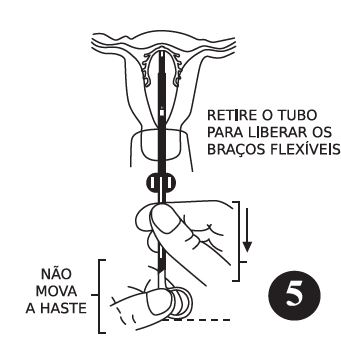 Imagem Complementar da Bula do diu cepeo omega cu 375 mini