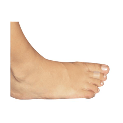 Tubo Recortável Para Calos, Siligel, Linha 4003 Orthopauher
