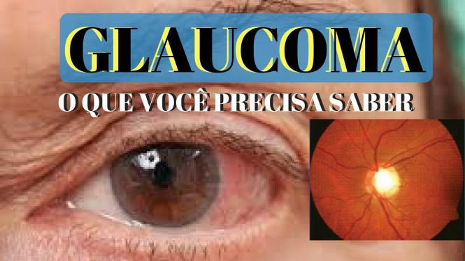 Xelacom