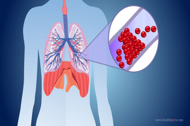 Xarelto para embolia pulmonar